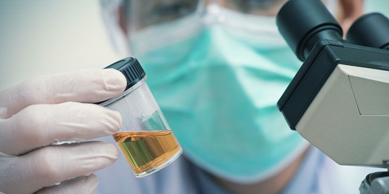 Beispiele Dafür, Worauf Ein Labor Eine Urinprobe Testet
