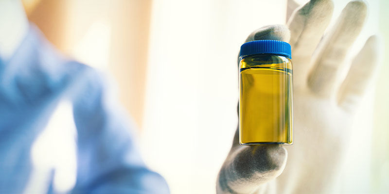Was Passiert, Falls Du Einen Drogentest Nicht Bestehst?