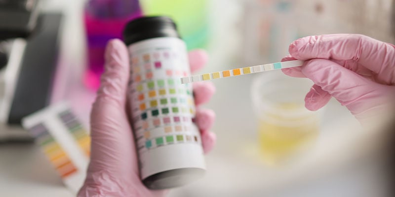 Kratom-Drogentests