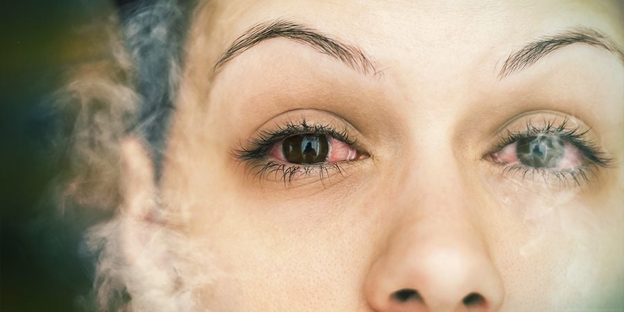 Was verursacht rote Augen? cannabis