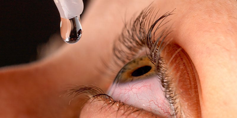 Tipps, was man gegen durch Cannabis gerötete Augen machen kann
