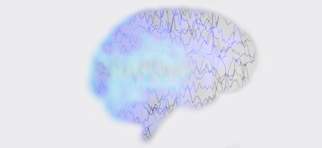 CBD und Epilepsie CBD und Epilepsie
