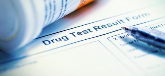 10 Mythen Über Das Bestehen Eines Drogen-Urin-Tests