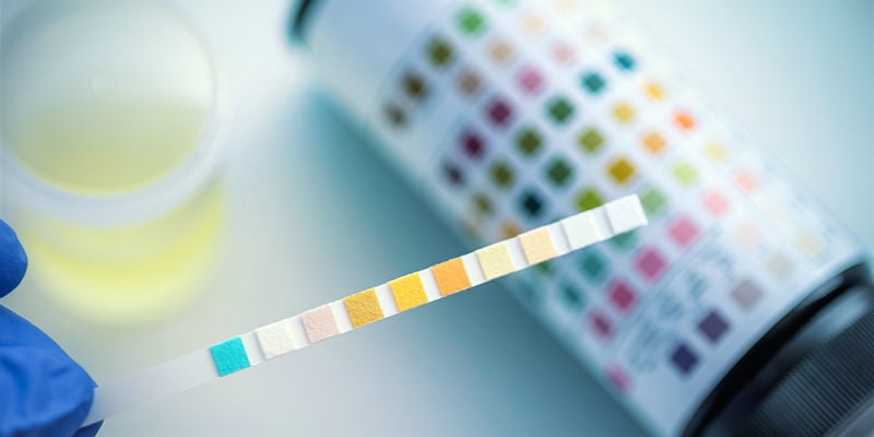 Drug testing in sports: THC and CBD