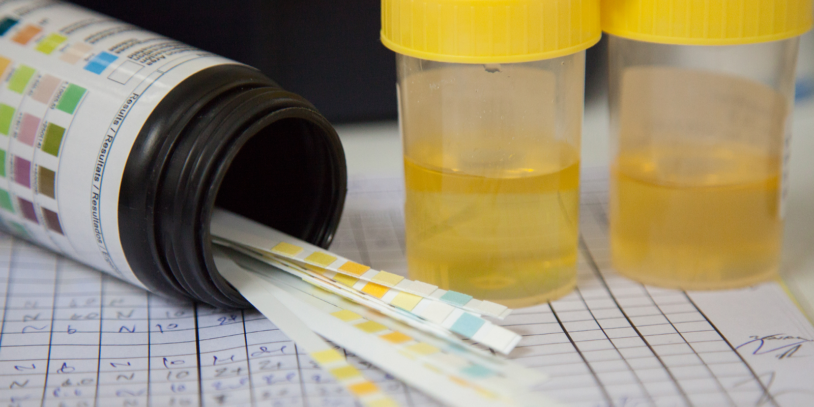 Myth 10: You can store or “pre-pass” urine for later
