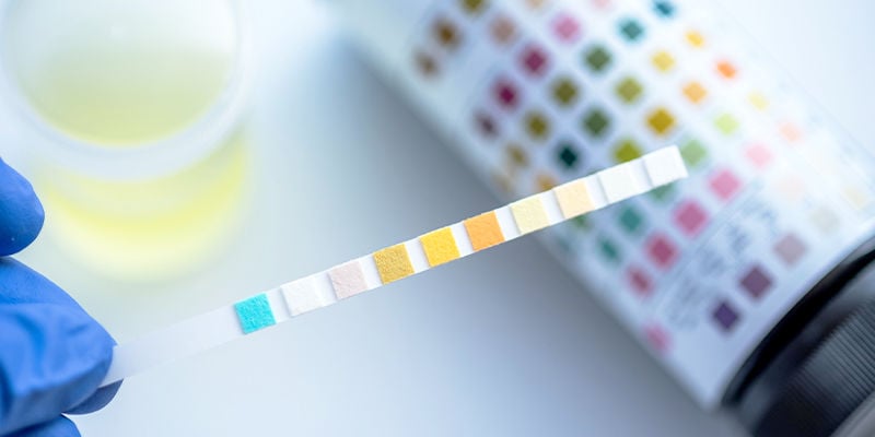 How do THC drug tests work?