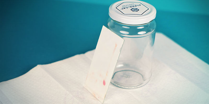 Alpha-Cat Cannabinoid Test Mini Kit: Reveal The Test Results