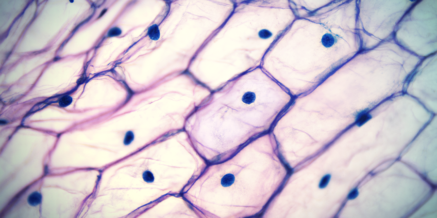 Vacuoles VACUOLES