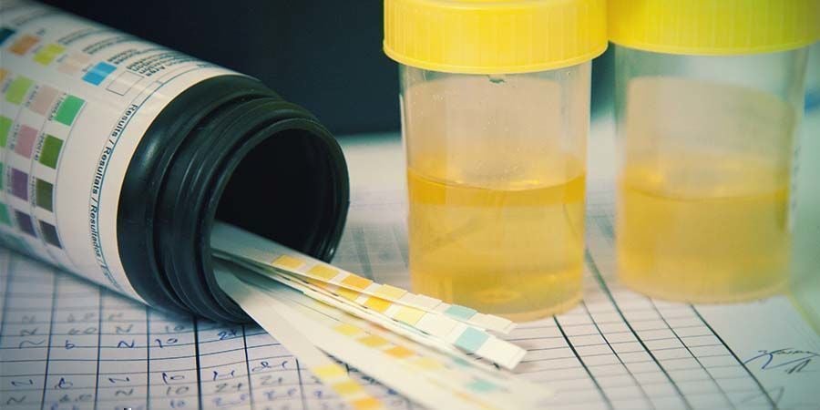 drug testing methods: Urine