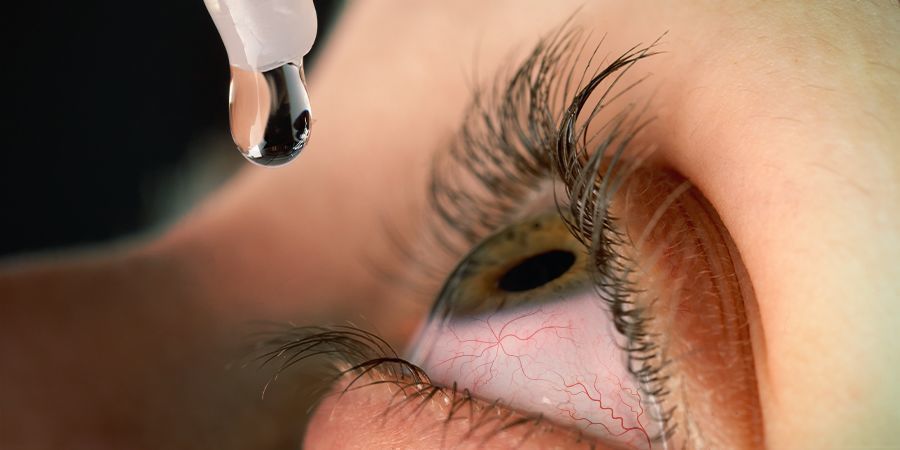 HOW TO TREAT RED EYES cannabis